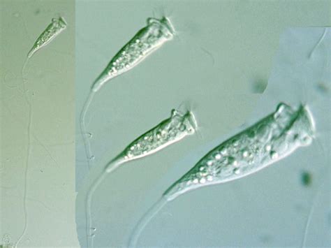 Epistylis! A Microscopic Marvel That Combines Colonial Living With Remarkable Feeding Strategies