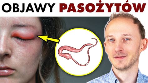  Iksodidae -  Pasożytnicze robaki niosące problemy zdrowotne dla człowieka i zwierząt!