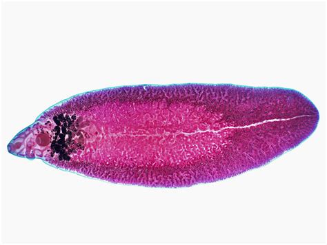  Liver Fluke: A Microscopic Mastermind Behind Misery